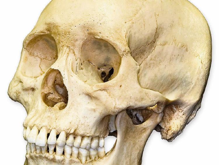 Skull left on Naas doorstep 