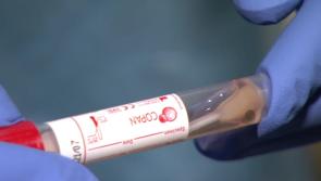 Hospitals under 'huge stress' due to rising Covid patient numbers