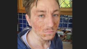 Dublin man has been located safe and well, gardaí confirm