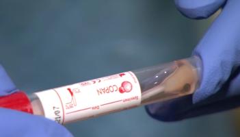 More than 10,000 Covid cases confirmed today as restrictions end
