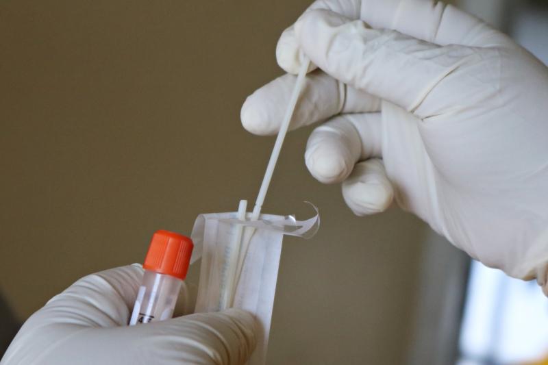 Covid-19 PCR tests within a day or two labelled 'impossible' 