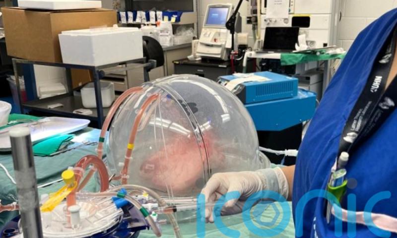 Scientists convert lungs to universal blood type in step towards neutral organ transplants