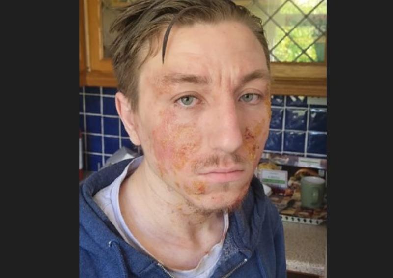 Dublin man has been located safe and well, gardaí confirm