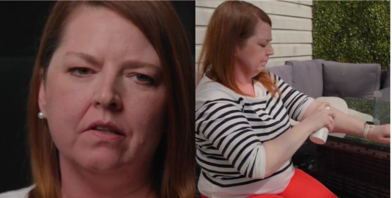 Irish woman with skin cancer warns people ahead of extreme 29 degree weather 